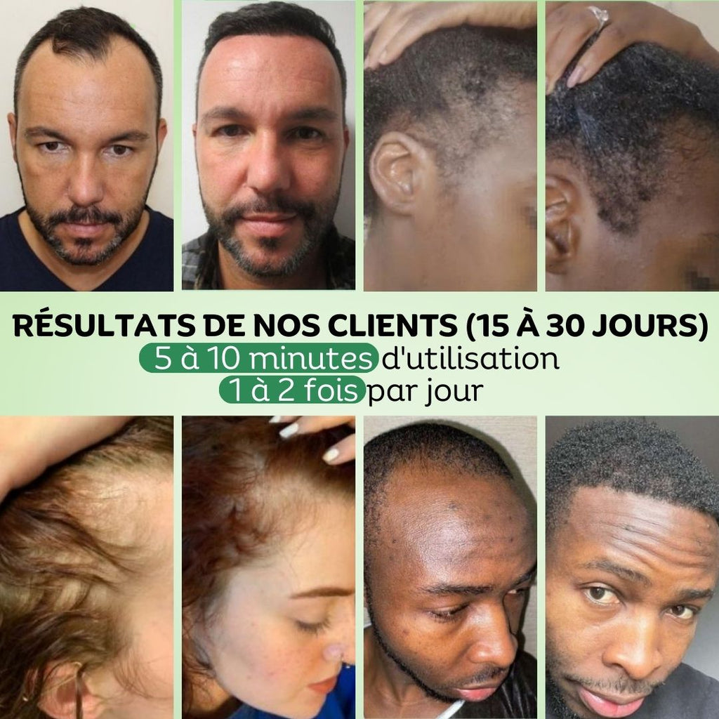 Pack Régulation & Exfoliation Vivaci-1