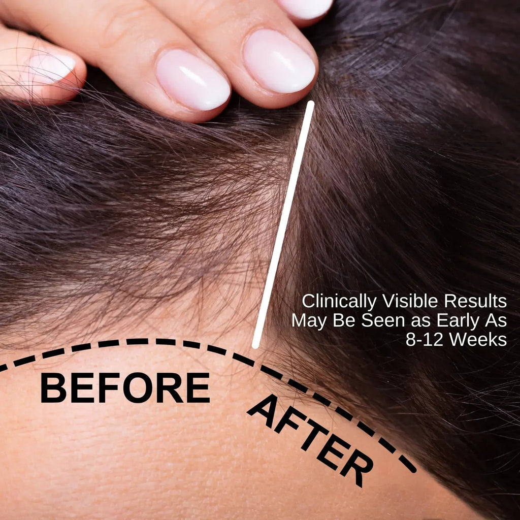 Natural Hair Oil for Hair Thinning & Scalp Nourishment (50ml) | Ammuri-2