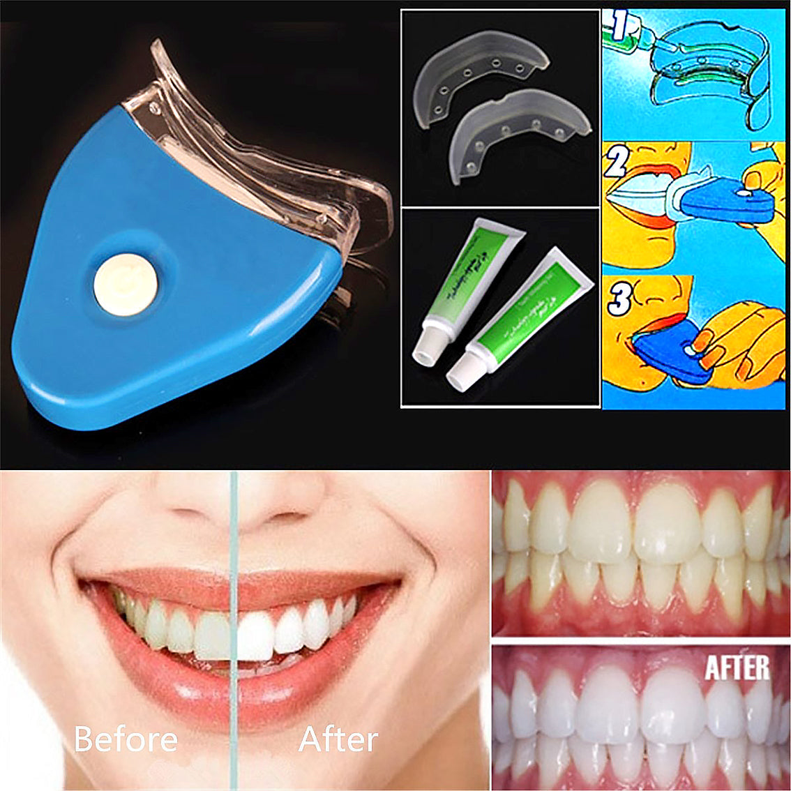 Oral Gel Teeth Tooth Whitening Whitener Dental Bleaching LED-0